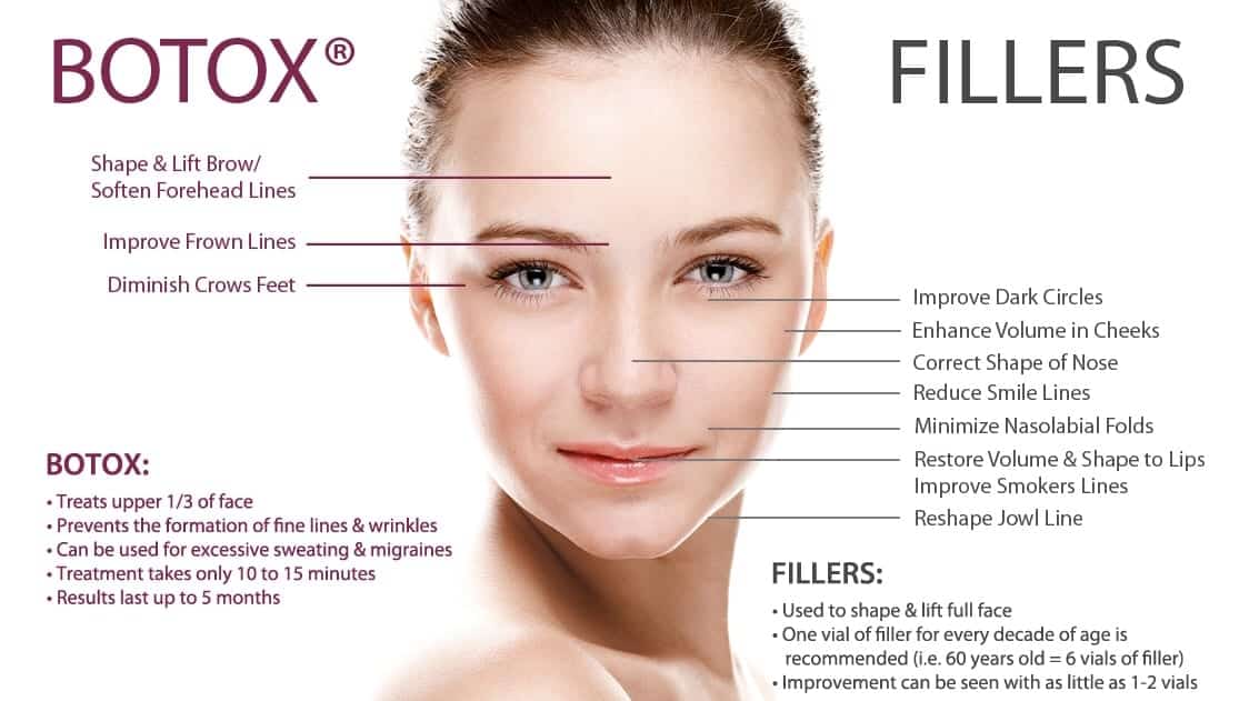 botox fillers dermatology