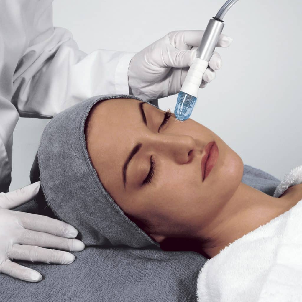Microdermabrasion in Richmond, BC illustration 1