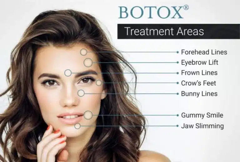 best botox treatment in richmond 768x518.jpg