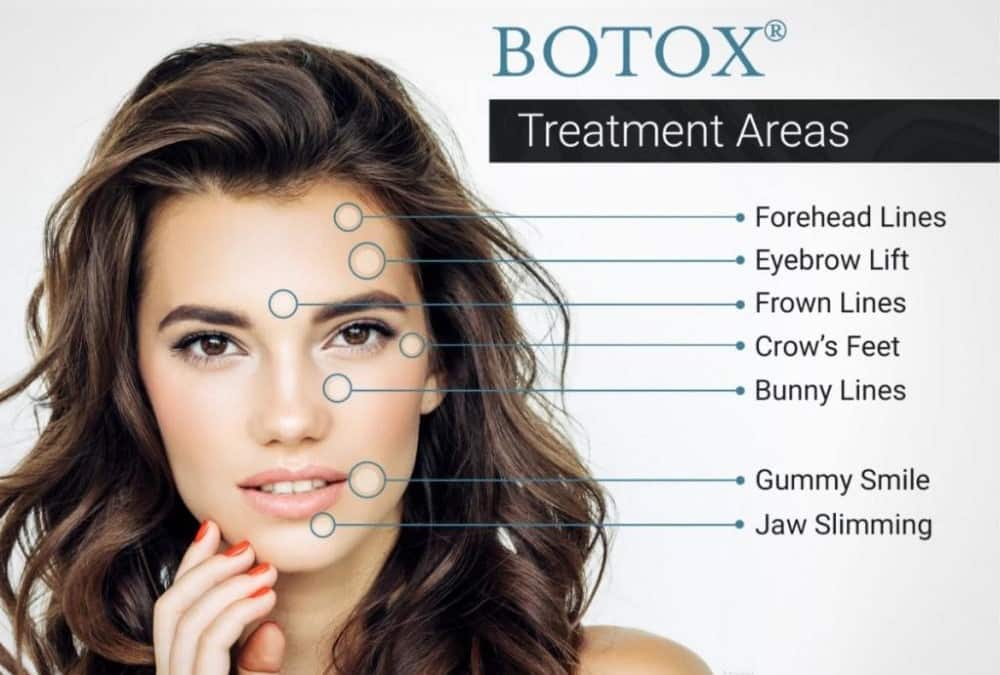 best botox treatment in richmond