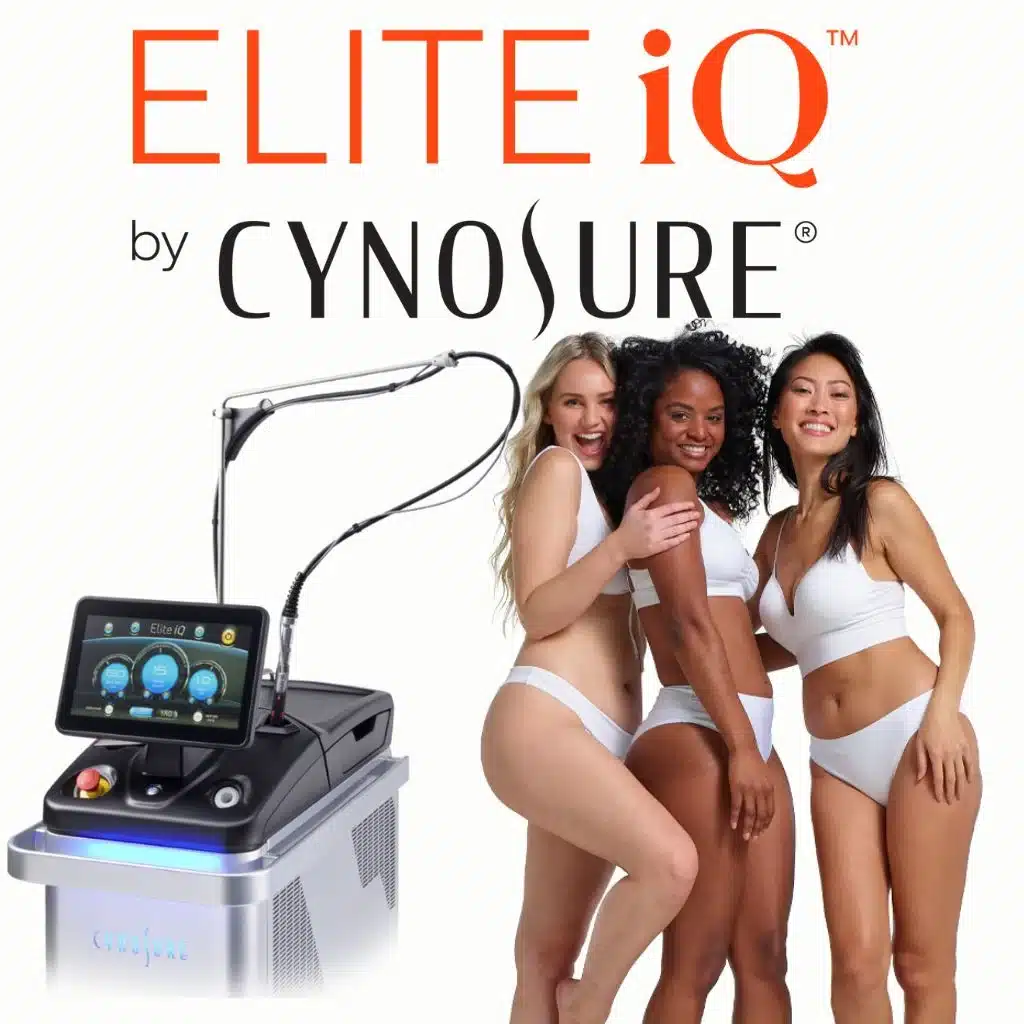 Cynosure Elite iQ Laser Treatments in Richmond, BC illustration 1
