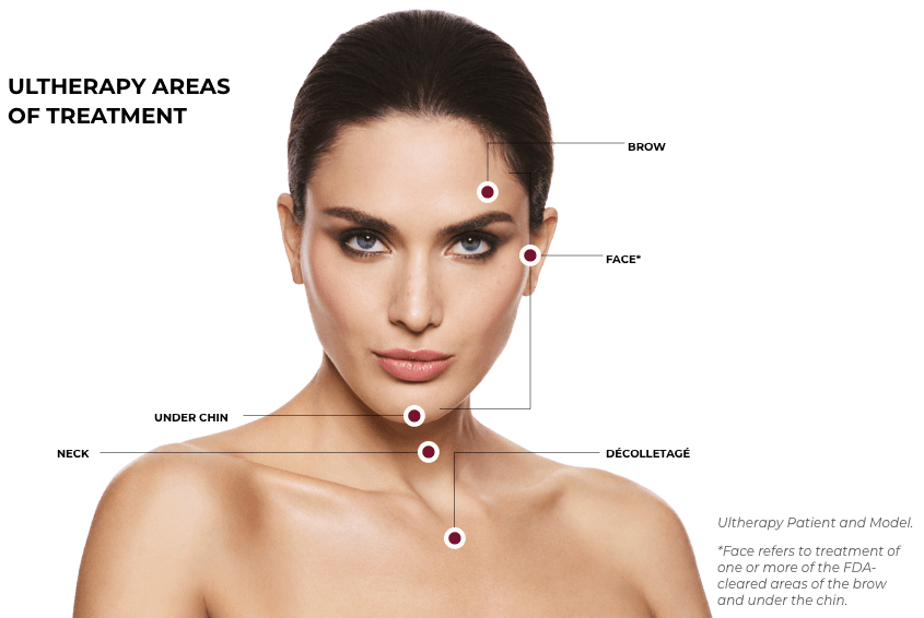 Ultherapy in Richmond, BC illustration 1