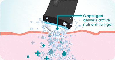 How It Works? illustration 2