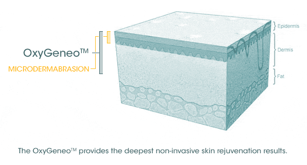 OxyGeneo Super Facial in Richmond, BC illustration 1