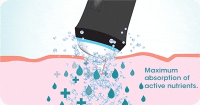 How It Works? illustration 3