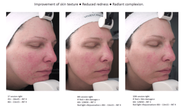 Highly-Effective For A Variety Of Skin Conditions: